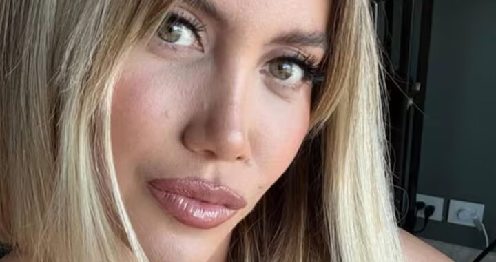 Mirá cómo luce la cintura de Wanda Nara luego de su última cirugía