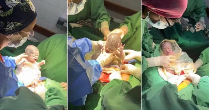 Nacieron trigemelas en el Hospital Público Materno Infantil de Salta: un caso único