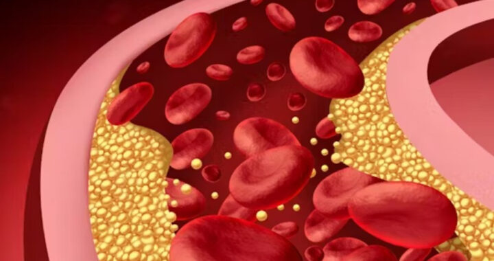 El vegetal que limpia el hígado, baja el colesterol y mejora la digestión, según expertos